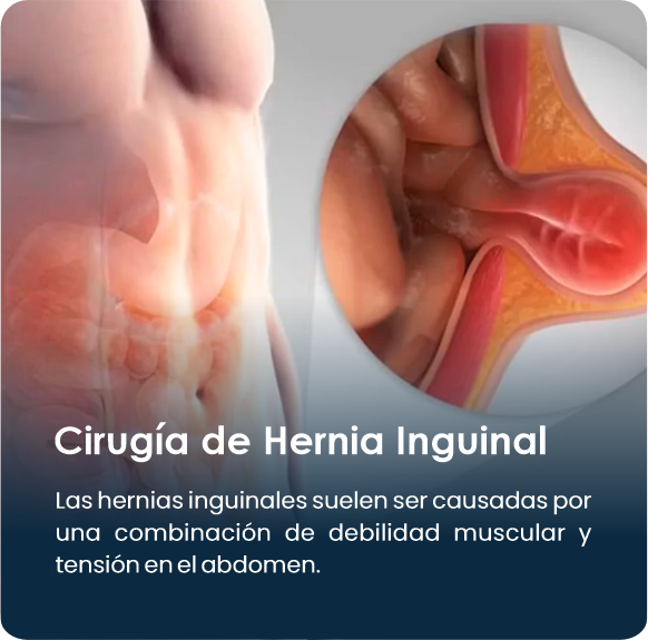 Cirugia_de_Hernia_Inguinal_1