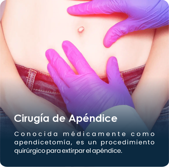 Cirugia_de_apendice2