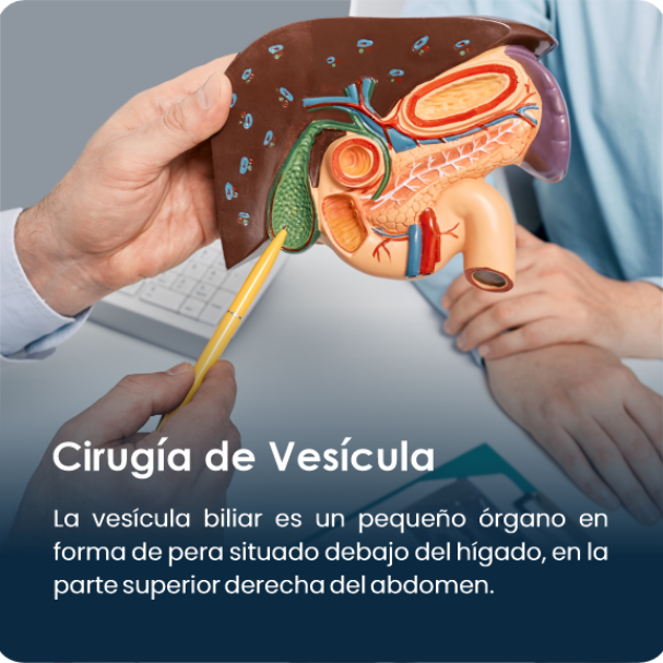 Cirugia_de_vesicula2