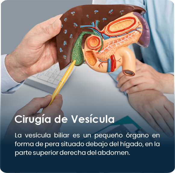 Cirugia_de_vesicula2