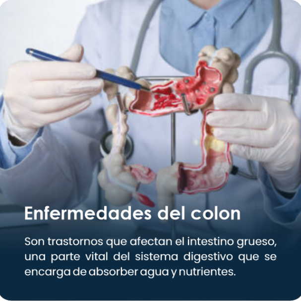 Enfermedades_Del_Colon2