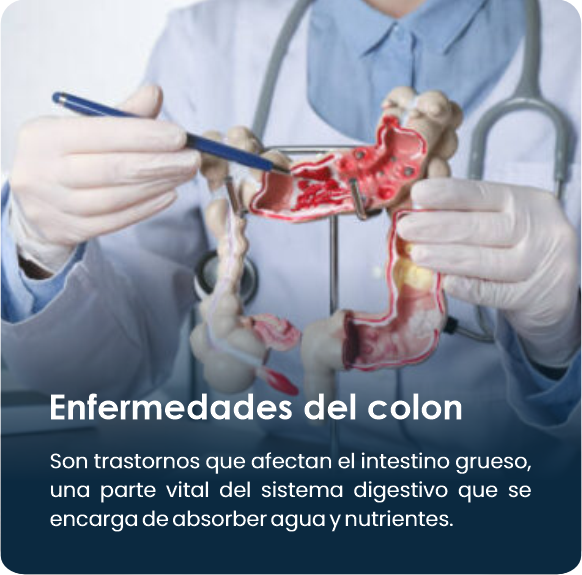 Enfermedades_Del_Colon2