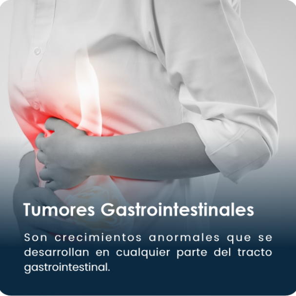 Tumores_Gastrointestinales_12